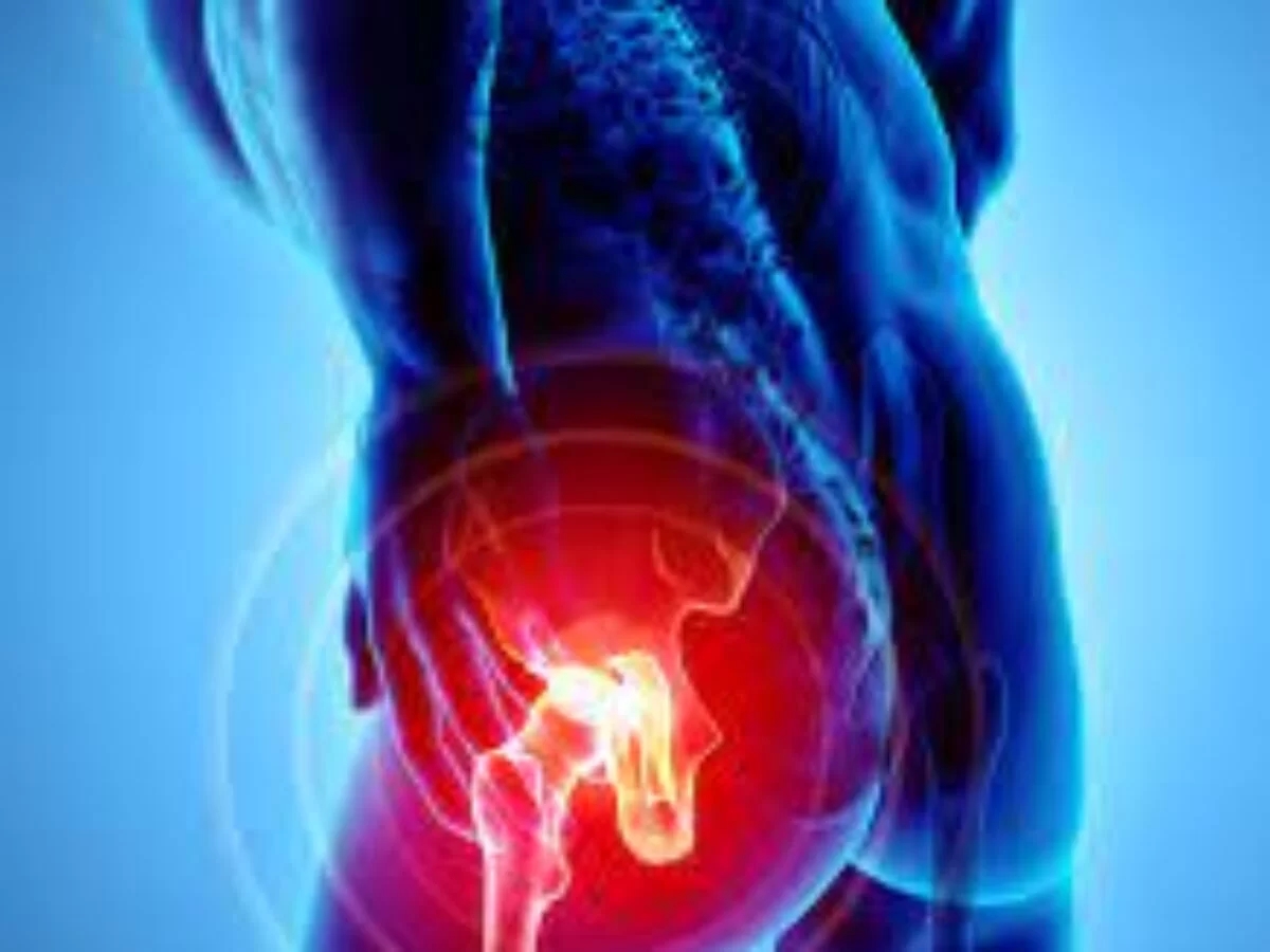 Deep gluteal syndrome